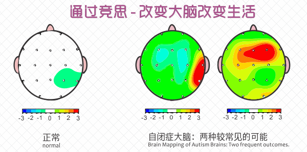 自闭症训练方案
